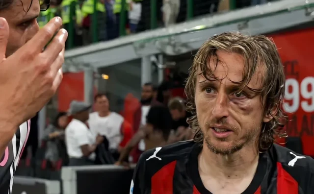Luka Modrić ozljeda na licu