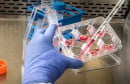 hantavirus