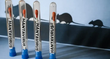 Hantavirus