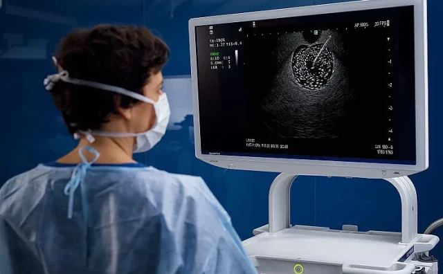 Pacijenti više ne moraju ići u inozemstvo: Endoskopski ultrazvuk u Vitalisu dostupan uz uputnicu