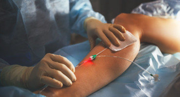 laserska kirurgija Vitalis