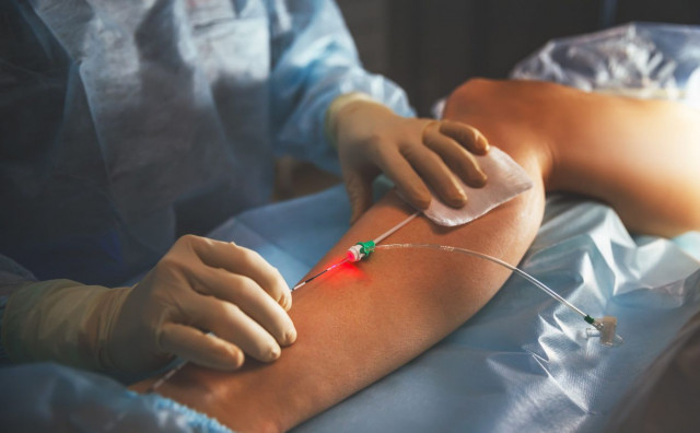 laserska kirurgija Vitalis